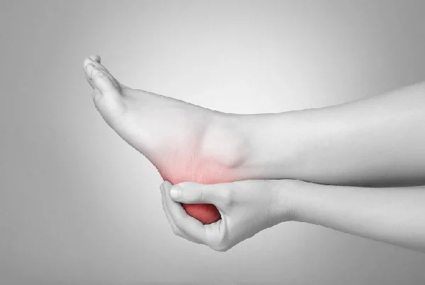 Calcaneal Spur Physiotherapy