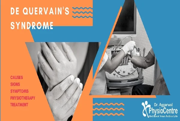 De Quervains Syndrome Physiotherapy