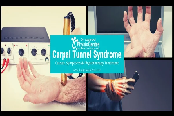 Carpal Tunnel Syndrome Physiotherapy