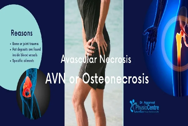 AVN Treatment without Surgery